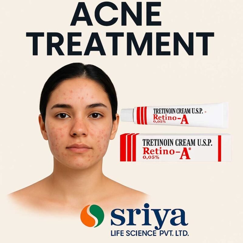 Acne Treatment